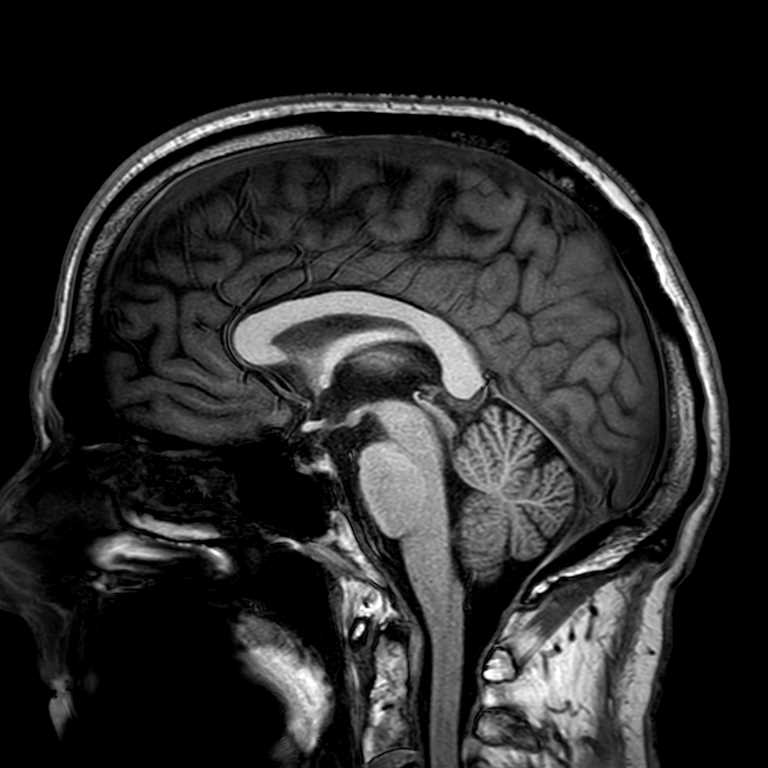 Daily Moan-mri-1-jpg