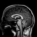 Daily Moan-mri-1-jpg