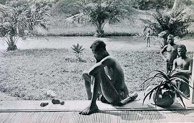 Interesting Black and White pictures ripped from the net-childs-severed-hand-foot-congolese-man