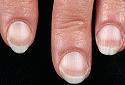 Dinner-mh_photo_of_pale_fingernails-jpg