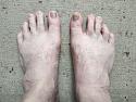 Show us yer toes - WARNING GRAPHIC-feet_20220121_121600-jpg
