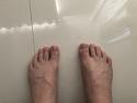 Show us yer toes - WARNING GRAPHIC-f41063c7-39e8-4e95-889d-0cad190a8950-jpg